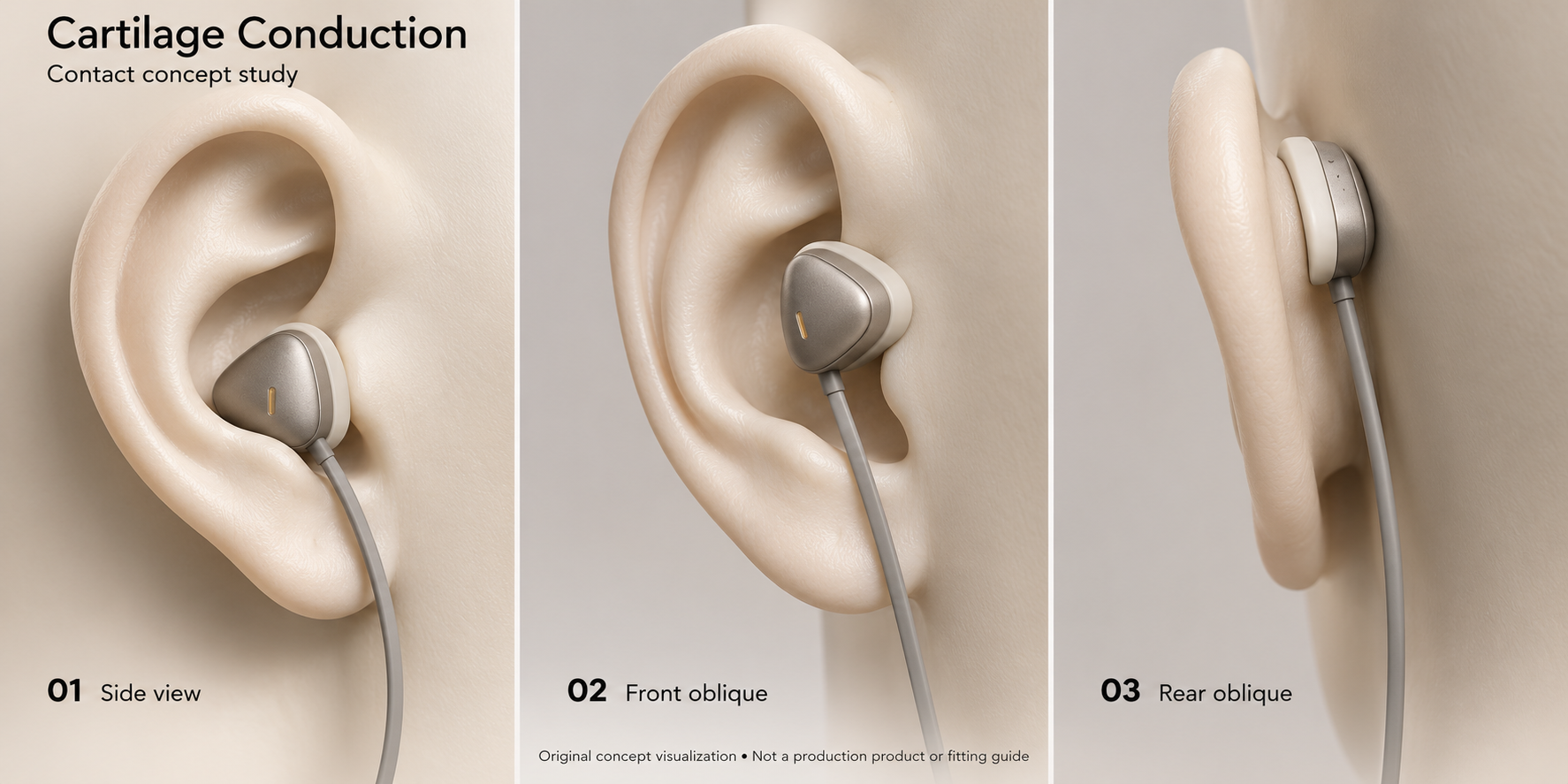 Three conceptual views of an ear-worn contact device, showing side, front-oblique and rear-oblique interfaces